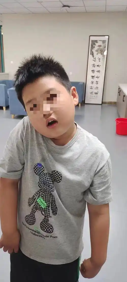 【迁医健康】这个小朋友突然脖子歪了 怎么办?_症状_颈部_治疗