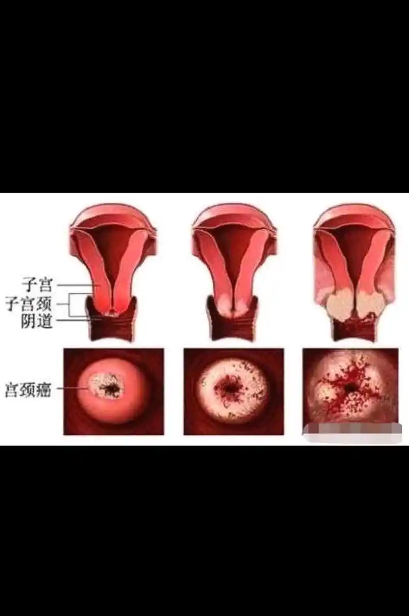 这些妇科病你有吗?真的很严重嘛?
