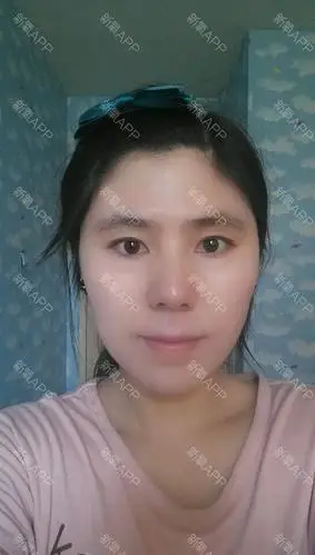 颧骨高额头窄特别显老愁死了