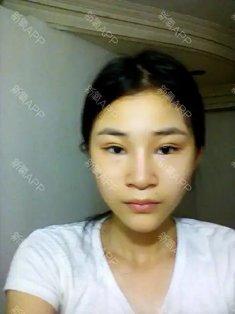 我眼睛适合欧式双眼皮麽我眉眶骨突出眼睛内凹就是眼睛_圈子-新氧美容