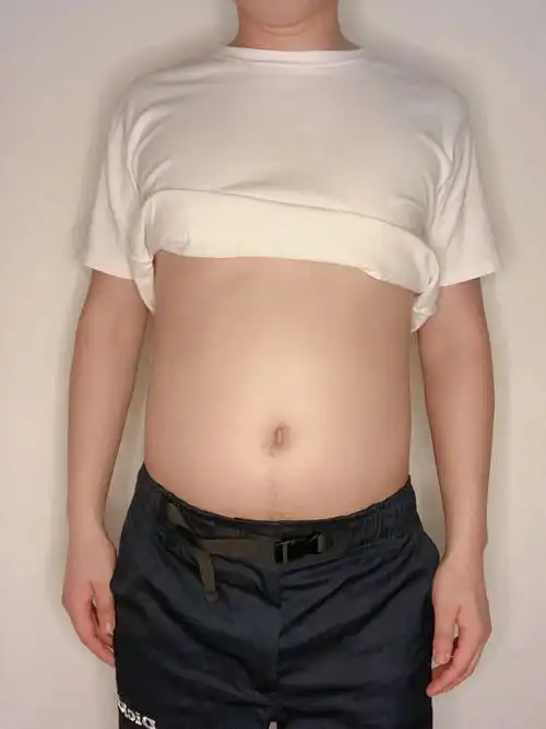 男士啤酒肚怎么办?