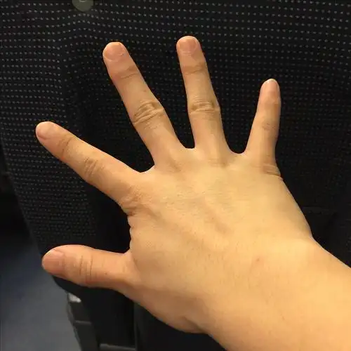 手掌宽就算了,手指还短,更蠢的是关节也大,手比有的妹子手还小.