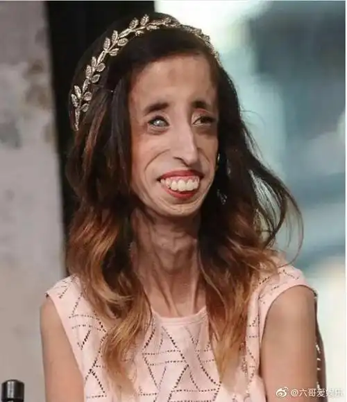 世界上最丑的女人