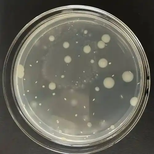 快自查菌落总数的错误操作你中招了没