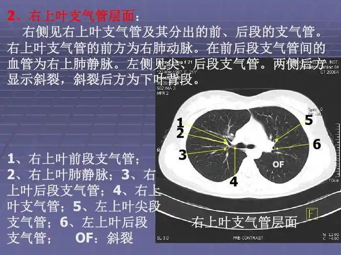 正常胸肺部ct影像学表现ppt