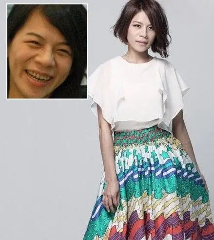 整牙比整容还好用 女明星靠它变天仙