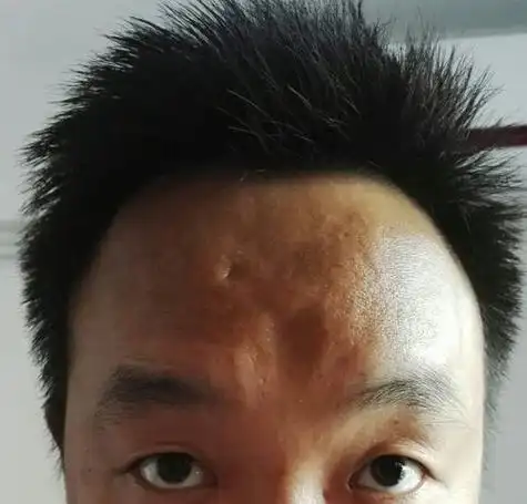 额头凸的侧面图