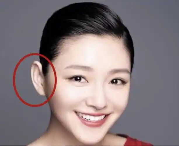 招风耳|耳垂|耳廓|外耳_网易订阅