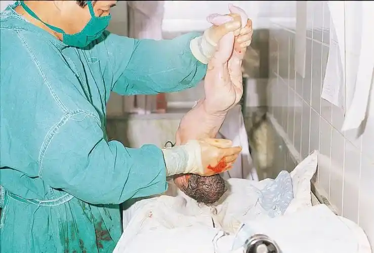 胆小勿看实拍孕妇顺产惊心全过程为全天下的妈妈点赞