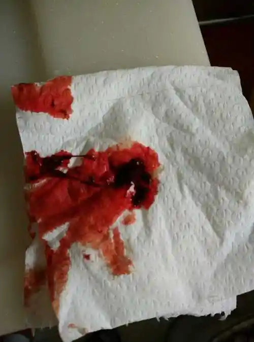 我有可能流产了