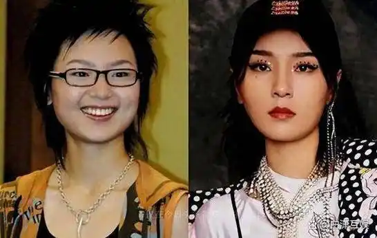 回顾周笔畅整容成功大方承认本想照着杨幂整整出来却像杨紫