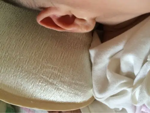 宝宝耳朵尖怎么办?有没有和我家一样的,有什么办法