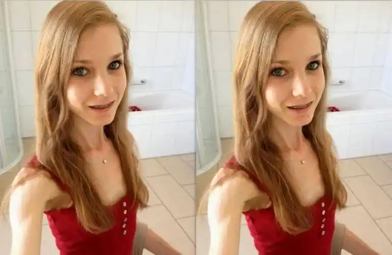 原创还记得那位60斤骨瘦如柴的女孩看到她的现状网友羡慕了