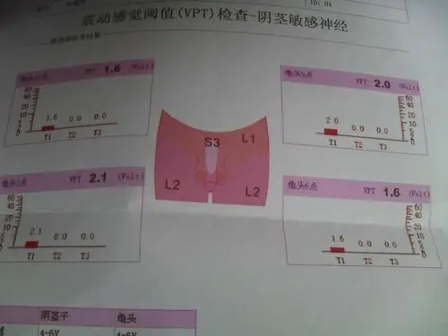 男科早泄问题,有图,希望高人专家帮我看看,这个检测出来有问题吗?