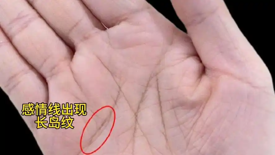 感情线出现长的"岛纹"有何意义?