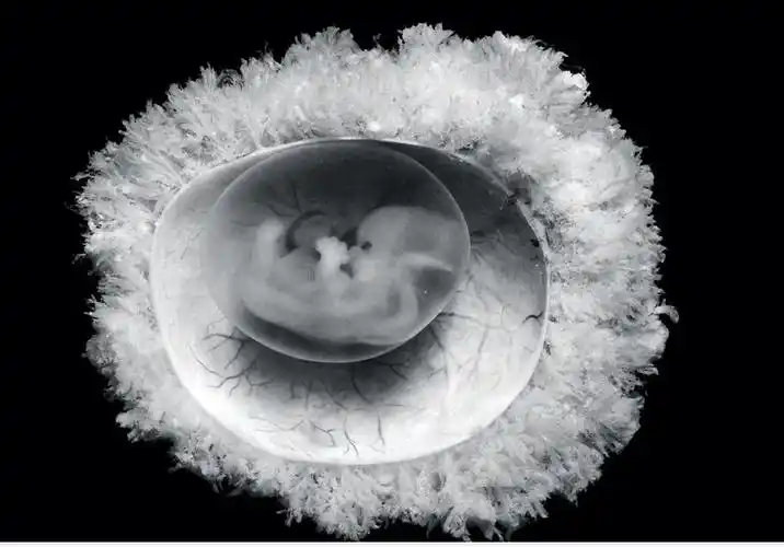 第45天的人类胚胎;摄影:omikron/science source.