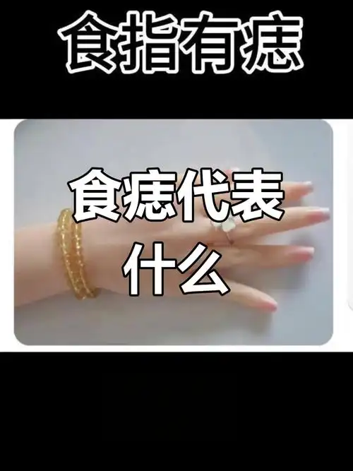 食指痣的含义解析