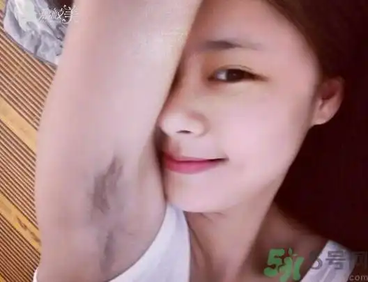 冰点脱毛帮你更好的解决体毛问题