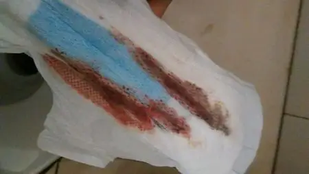 少数女性会一些红色或粉红色的血迹,这就叫做着床出血