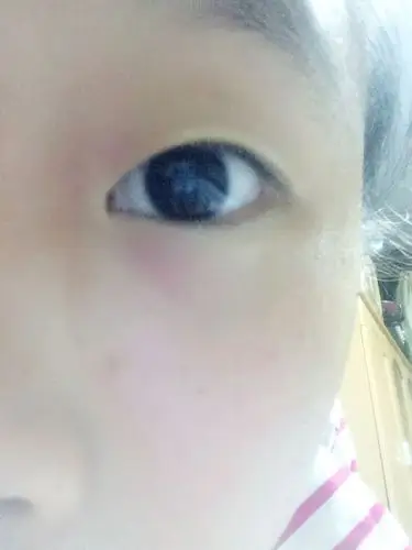 单眼皮的我是什么眼型?_百度知道