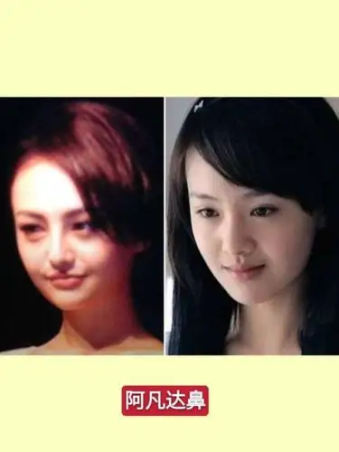 郑爽换脸6次还能再整了么0471扒一扒郑爽整容史75