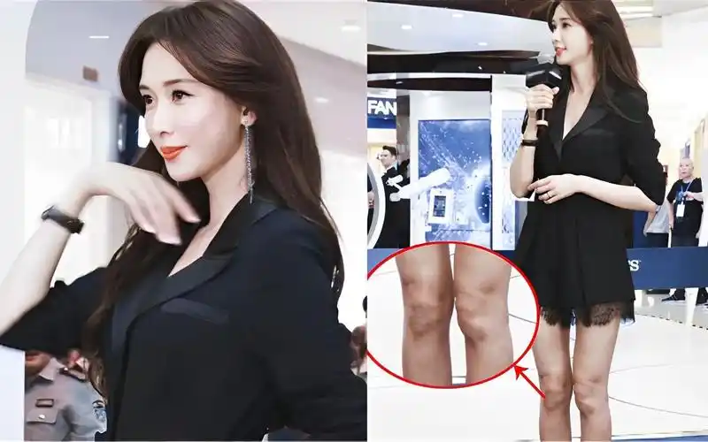 曝"台湾第一美女"林志玲近况,双腿成x型引热议,谁欺负女神?