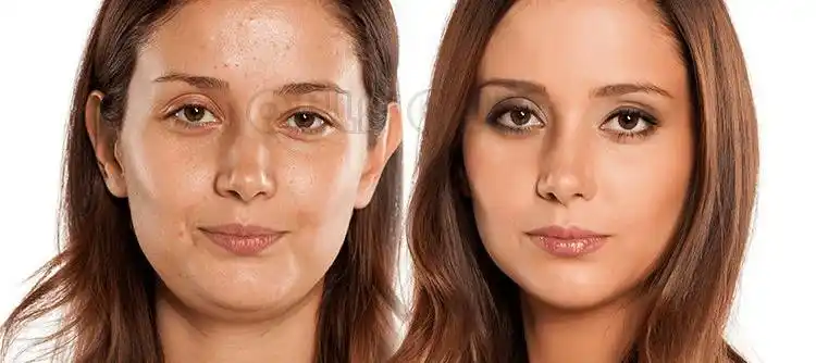 干细胞填充效果是永久的吗面部的衰老除了面部组织松弛和移位,还有