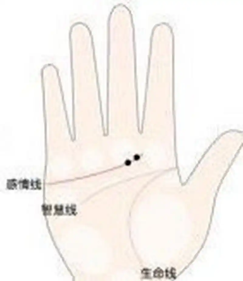[cp]感情线上有痣的手相分析:  在感情线上长痣的人,对于感情和欲望感