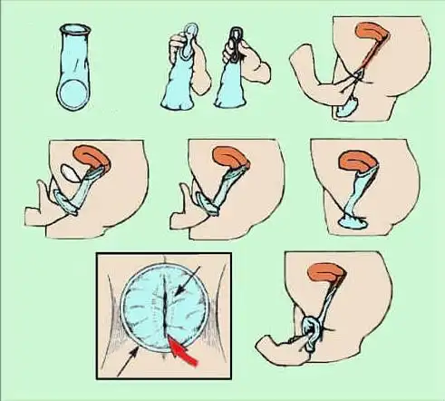 女用避孕套使用手册,好用吗