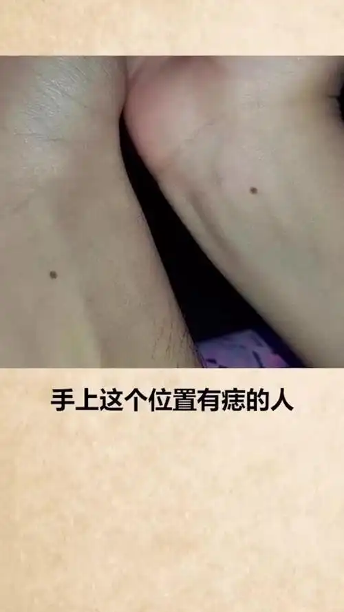 每天一点冷知识手臂上有痣的人长相绝对好看快看看你有吗