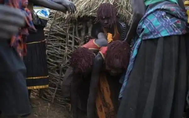 02割礼是一种习俗,分为男性割礼和女性割礼两种.男性割