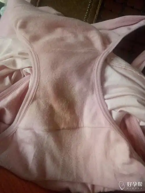 怀孕四个月内裤流好多白带,内裤都湿了这是白带拉丝吗今天是月经第14