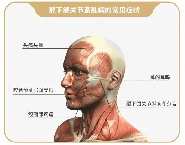 颞下颌关节紊乱这个病一辈子都治不好了科维奇颌垫给你希望