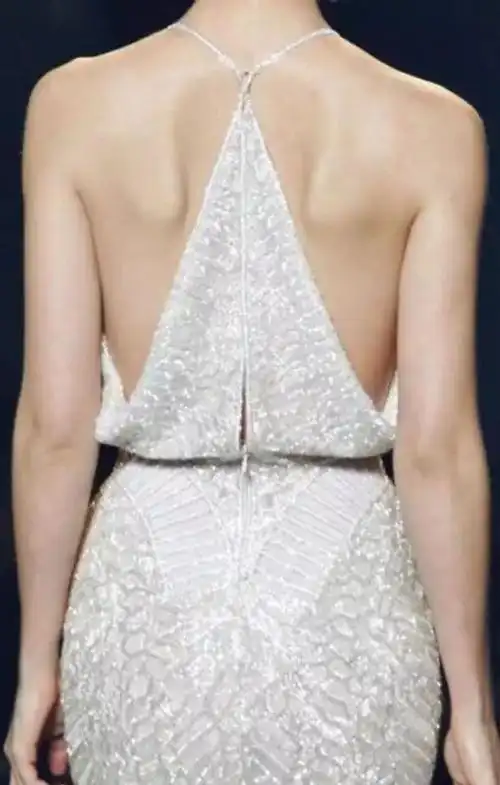 蝴蝶骨是什么样子的图片 这种骨骼形态是不健康的吗