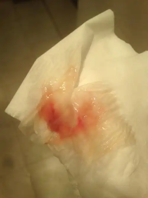 请问有经验的宝妈这是见红吗(有图)