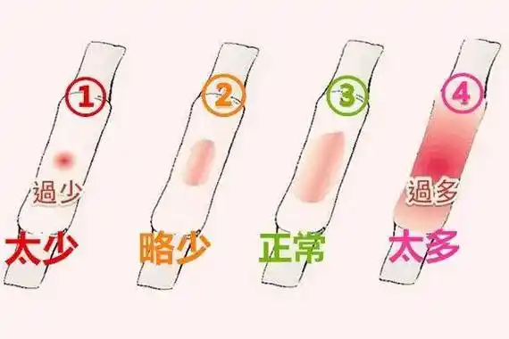 每月正常的经血量在5-80ml的范围,总量超过80ml就是经血过多,总量小于