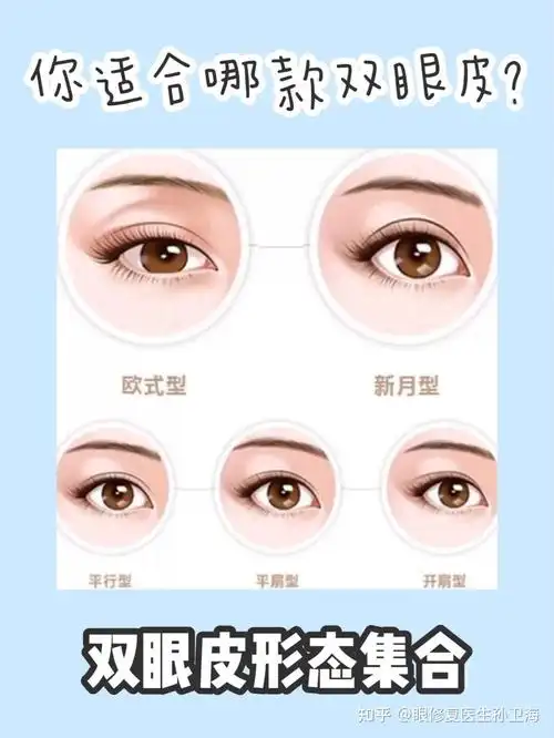可以问一下这个双眼皮是哪种类型吗? - 知乎