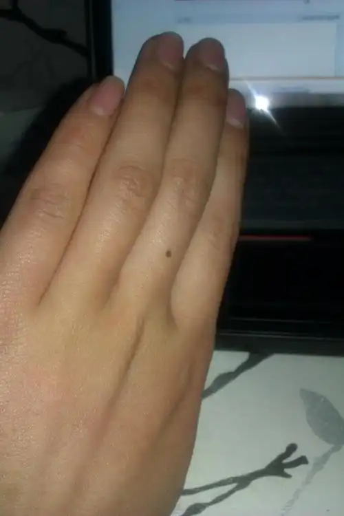 同问左手中指中间有颗黑痣