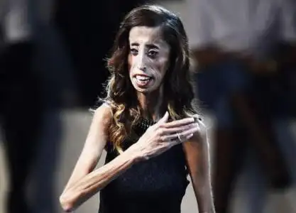 癌症病人化疗以后瘦成皮包骨,这正常吗?营养怎么补?