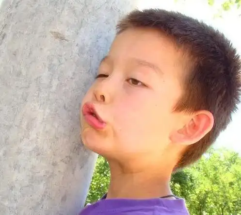 为啥我的孩子越长越丑,检查结果让我不愿接受,鬼脸综合征可咋办