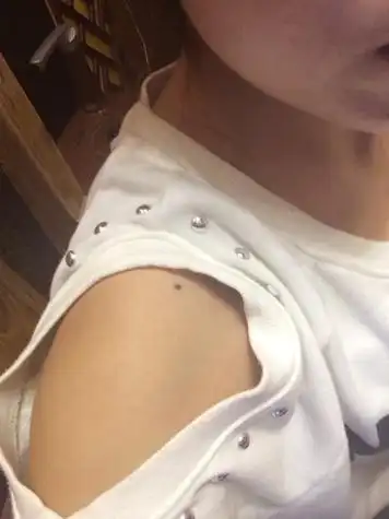 肩上有颗痣有什么说法