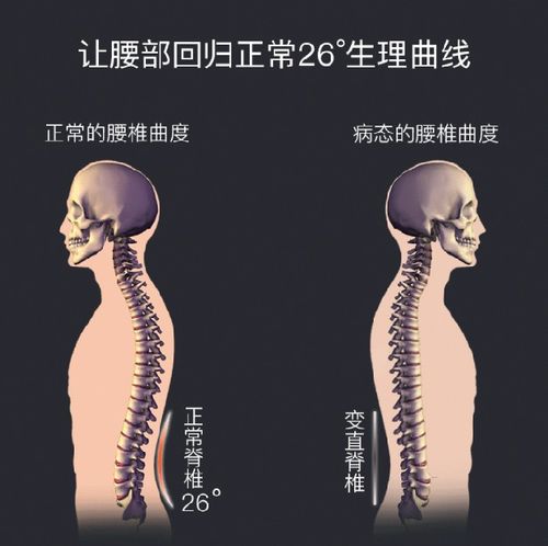 瑜伽午睡腰靠枕护颈护腰垫人体工程学塑形含胸床垫