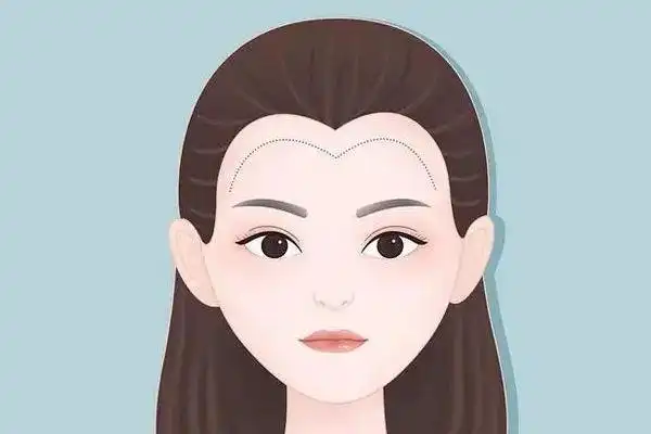 武汉做发际线一般多少钱啊 武汉做发际线的医院