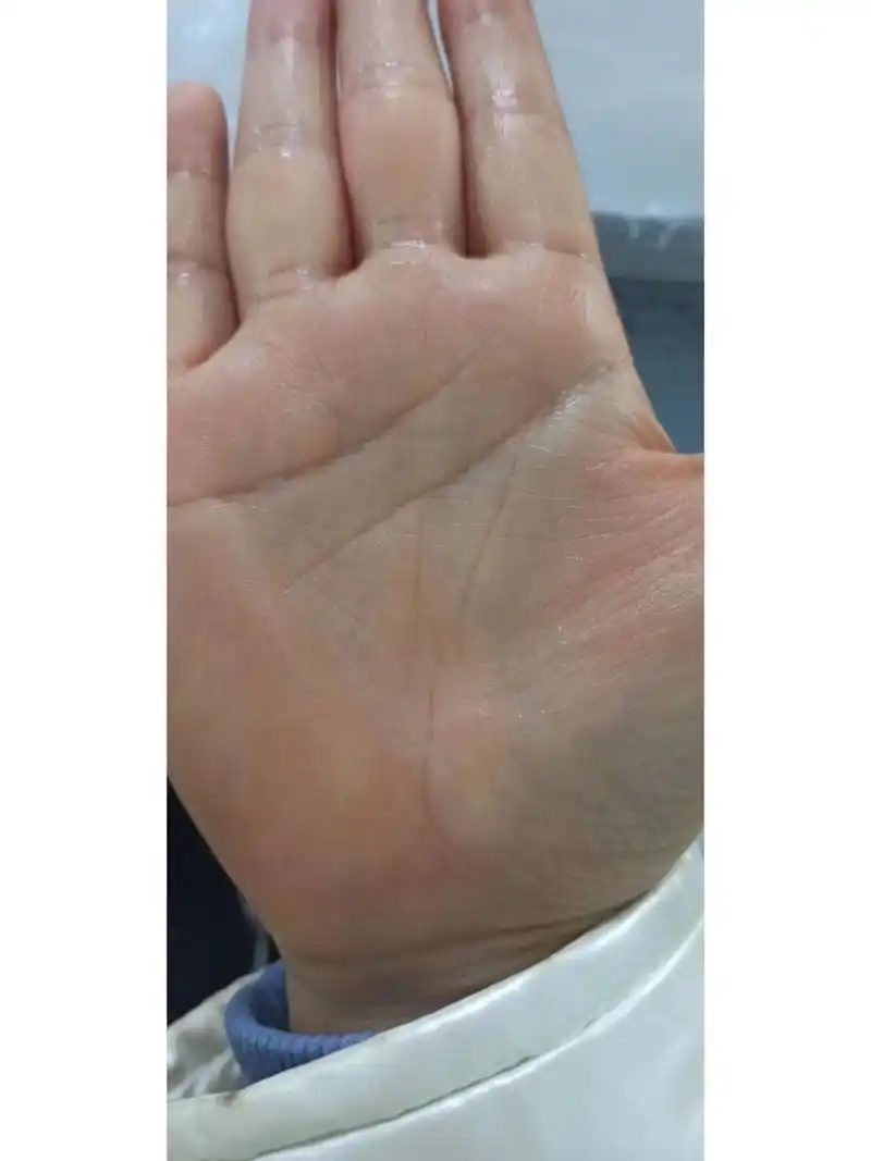 手相 双手生命线都短 分叉 短点 完蛋了 两只手生命线都短,一只手短