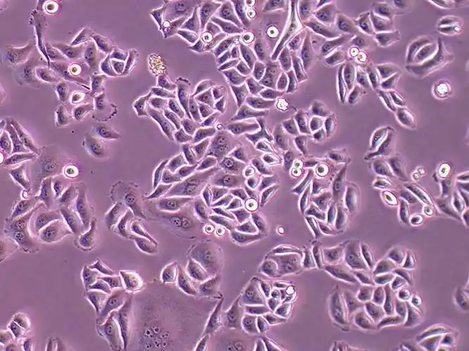 hela人宫颈癌细胞贴壁图