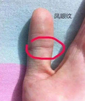 手有凤眼纹享有贵夫命