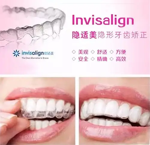 在别人毫无察觉中完成牙齿矫正全过程,看不出来图中美女带了隐形牙套