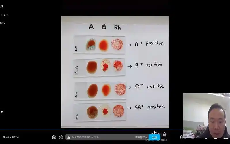 实验:abo血型鉴定
