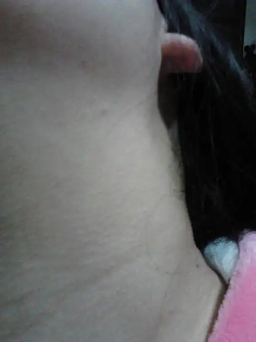 长很多白色的疙瘩,不痛不痒