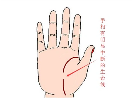 生命线断开错位命长久这是真的吗